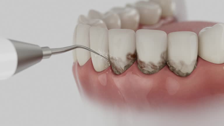 Reliable Dental contractor in Escanaba, MI by Dentist Open Now